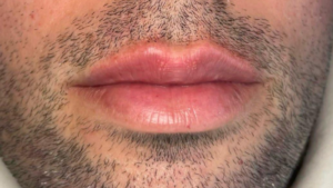 Dopo